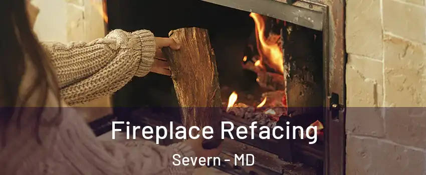  Fireplace Refacing Severn - MD